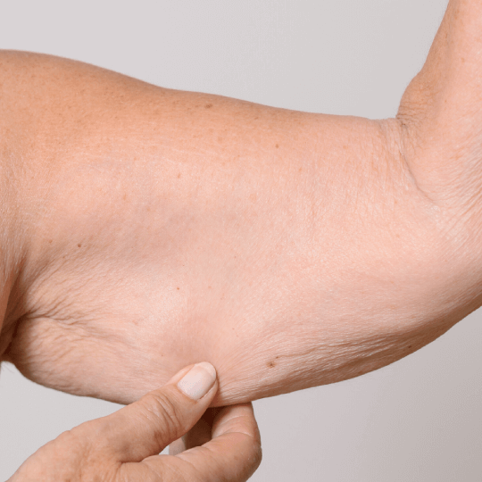 Behandeling tegen veroudering van de huid