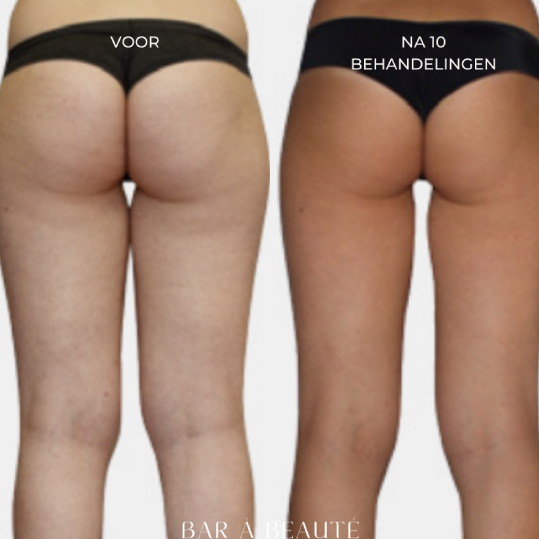 Hoe ontstaat huidverslapping en wat kan ik er tegen doen