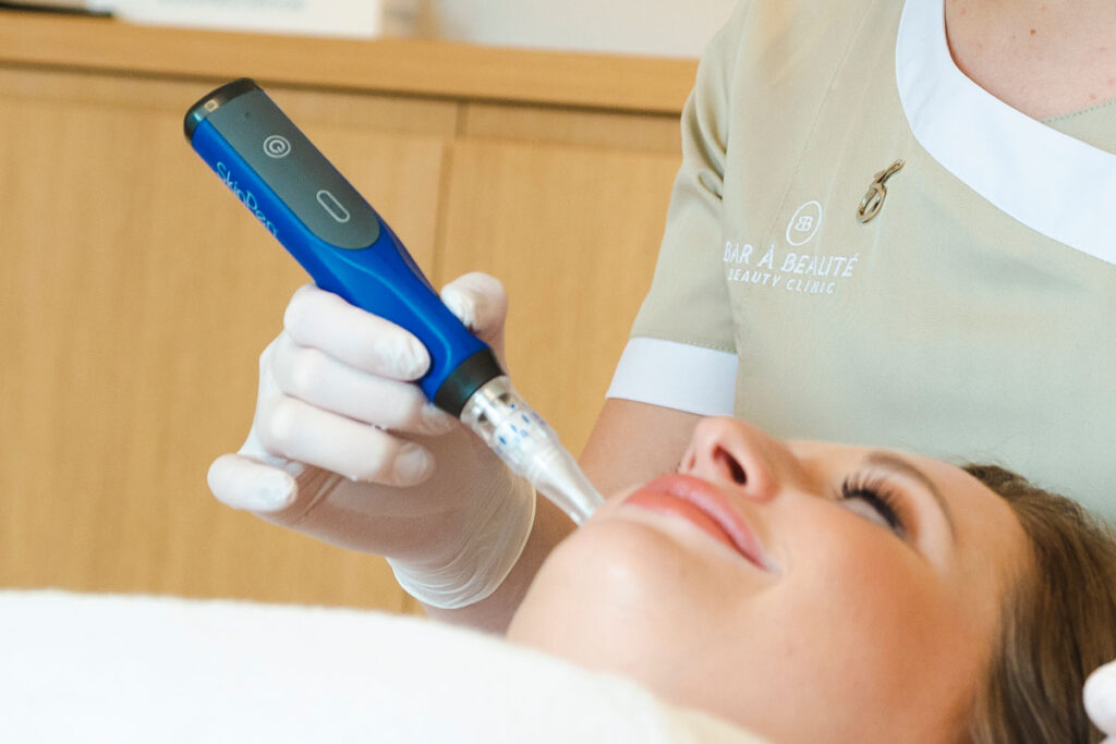 Microneedling behandeling met SkinPen voor verfijning van grove huidstructuur en zichtbare poriën bij Bar à Beauté in Knokke