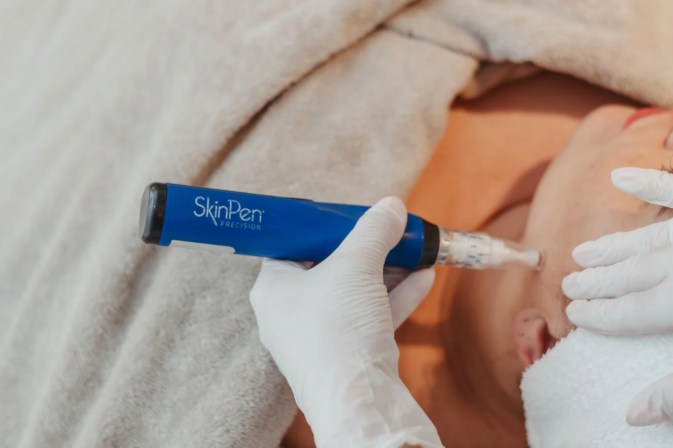 SkinPen microneedling behandeling voor huidverbetering bij Bar à Beauté